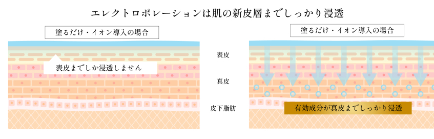 エレクトロポレーションは肌の新皮層までしっかり浸透します。